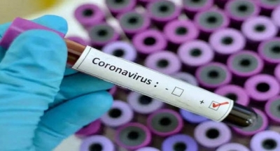 नोएडा में 107 नए कोविड मामले सामने आए, 33 बच्चे संक्रमित
