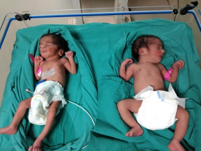मानसिक रूप से अस्थिर महिला ने सूरत के अस्पताल में जुड़वा बच्चों को छोड़ा