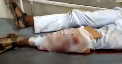 मप्र के भिंड अस्पताल में टूटे हुए पैर पर प्लास्टर के रूप में कार्डबोर्ड का इस्तेमाल