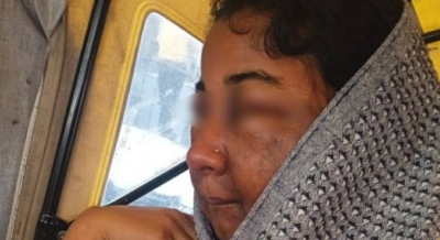मेकअप के बाद आईसीयू में भर्ती दुल्हन, हिरासत में ब्यूटीशियन